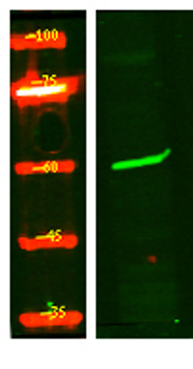 Western Blot analysis of HEK293 lysis, using primary antibody at 1:1000 dilution. Secondary antibody (STJS000791) was diluted at 1:10000