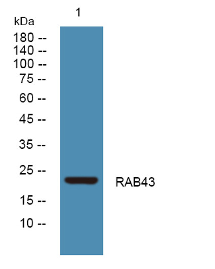 Western blot analysis of lysates from K562 cells, primary antibody was diluted at 1:1000, 4°C over night