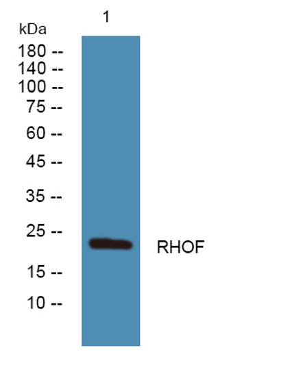 Western blot analysis of lysates from SH-SY5Y cells, primary antibody was diluted at 1:1000, 4°C over night