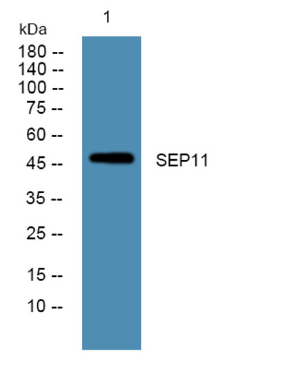 Western blot analysis of lysates from K562 cells, primary antibody was diluted at 1:1000, 4°C over night