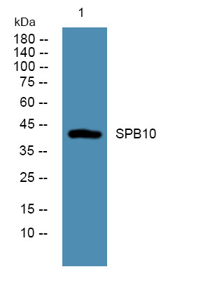 Western blot analysis of lysates from SH-SY5Y cells, primary antibody was diluted at 1:1000, 4°C over night