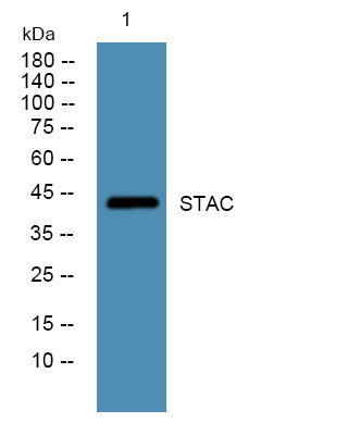 Western blot analysis of lysates from DU145 cells, primary antibody was diluted at 1:1000, 4°C over night