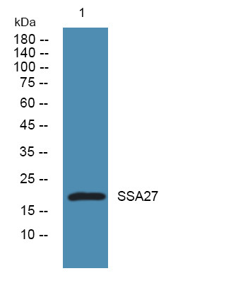 Western blot analysis of lysates from U2OS cells, primary antibody was diluted at 1:1000, 4°C over night