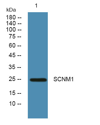 Western blot analysis of lysates from KB cells, primary antibody was diluted at 1:1000, 4°C over night