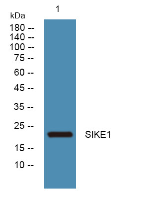 Western blot analysis of lysates from U2OS cells, primary antibody was diluted at 1:1000, 4°C over night