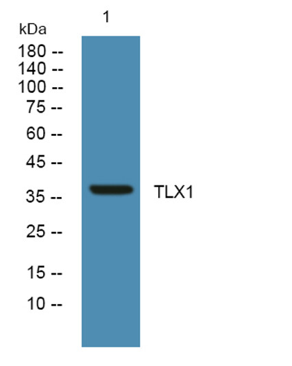 Western blot analysis of lysates from HCT116 cells, primary antibody was diluted at 1:1000, 4°C over night
