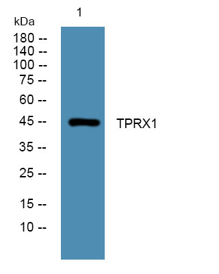 Western blot analysis of lysates from PC12 cells, primary antibody was diluted at 1:1000, 4°C over night