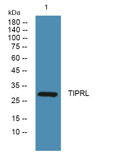 Western blot analysis of lysates from K562 cells, primary antibody was diluted at 1:1000, 4°C over night