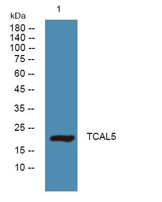 Western blot analysis of lysates from A431 cells, primary antibody was diluted at 1:1000, 4°C over night