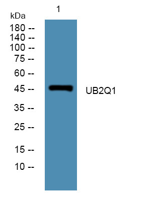 Western blot analysis of lysates from U2OS cells, primary antibody was diluted at 1:1000, 4°C over night