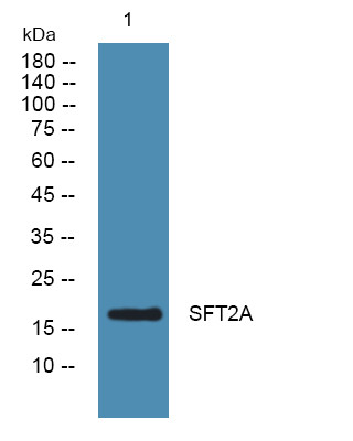 Western blot analysis of lysates from K562 cells, primary antibody was diluted at 1:1000, 4°C over night