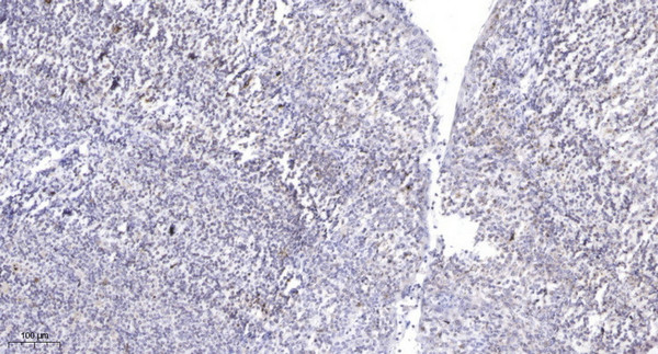 Immunohistochemical analysis of paraffin-embedded human tonsil. 1, Antibody was diluted at 1:200 (4°C overnight). 2, Tris-EDTA, pH9.0 was used for antigen retrieval. 3, Secondary antibody was diluted at 1:200 (room temperature, 45min).