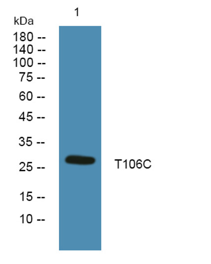 Western blot analysis of lysates from DU145 cells, primary antibody was diluted at 1:1000, 4°C over night