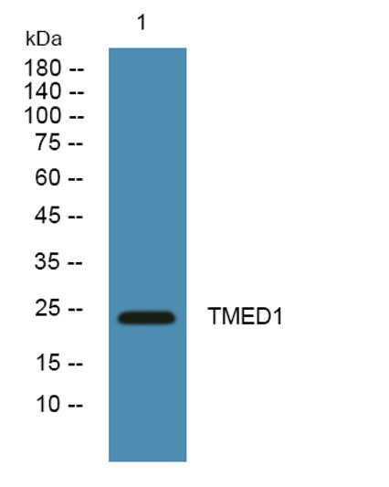 Western blot analysis of lysates from K562 cells, primary antibody was diluted at 1:1000, 4°C over night