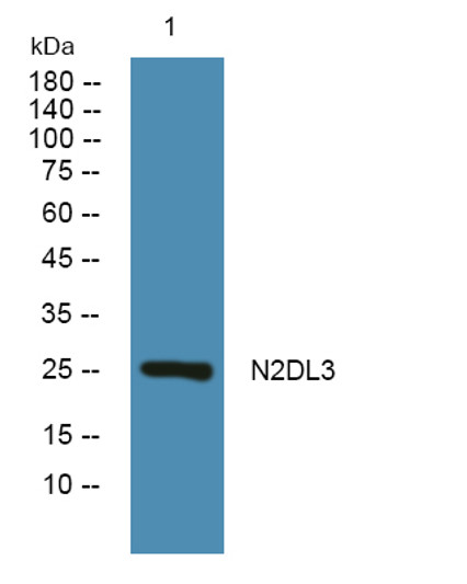 Western blot analysis of lysates from SH-SY5Y cells, primary antibody was diluted at 1:1000, 4°C over night Western blot analysis of lysates from SH-SY5Y cells, primary antibody was diluted at 1:1000, 4°C over night