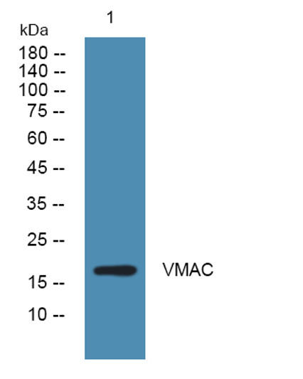 Western blot analysis of lysates from U2OS cells, primary antibody was diluted at 1:1000, 4°C over night