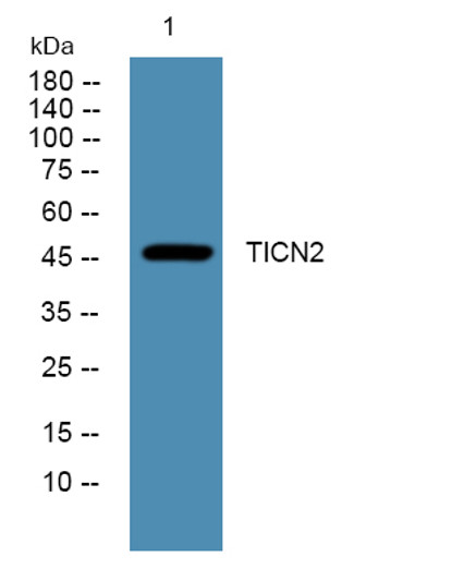 Western blot analysis of lysates from PC12 cells, primary antibody was diluted at 1:1000, 4°C over night Western blot analysis of lysates from PC12 cells, primary antibody was diluted at 1:1000, 4°C over night