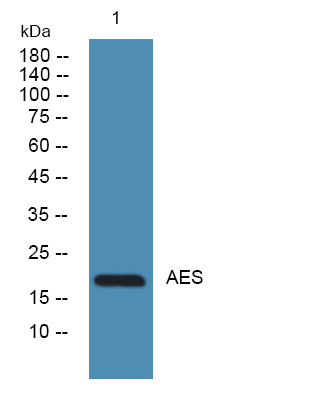 Western blot analysis of lysates from A431 cells, primary antibody was diluted at 1:1000, 4°C over night