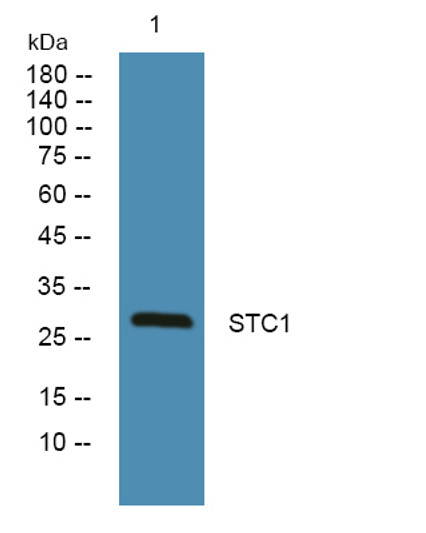 Western blot analysis of lysates from K562 cells, primary antibody was diluted at 1:1000, 4°C over night