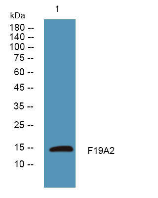 Western blot analysis of lysates from PC12 cells, primary antibody was diluted at 1:1000, 4°C over night