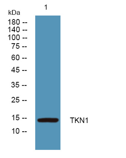 Western blot analysis of lysates from HCT116 cells, primary antibody was diluted at 1:1000, 4°C over night