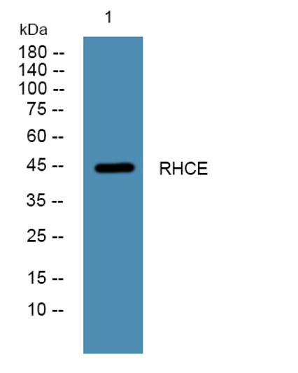 Western blot analysis of lysates from KB cells, primary antibody was diluted at 1:1000, 4°C over night