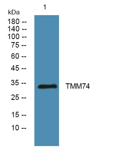 Western blot analysis of lysates from K562 cells, primary antibody was diluted at 1:1000, 4°C over night Western blot analysis of lysates from K562 cells, primary antibody was diluted at 1:1000, 4°C over night