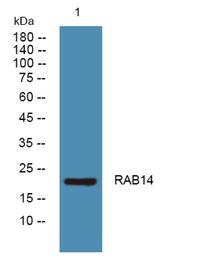 Western blot analysis of lysates from KB cells, primary antibody was diluted at 1:1000, 4°C over night