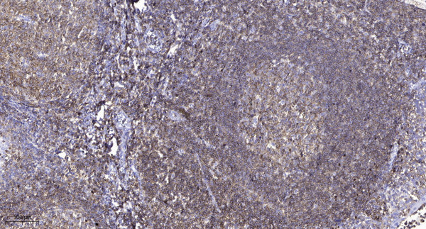 Immunohistochemical analysis of paraffin-embedded human tonsil. 1, Antibody was diluted at 1:200 (4°C overnight). 2, Tris-EDTA, pH9.0 was used for antigen retrieval. 3, Secondary antibody was diluted at 1:200 (room temperature, 45min).
