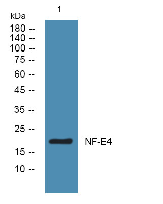 Western blot analysis of lysates from K562 cells, primary antibody was diluted at 1:1000, 4° overnight STJ193183