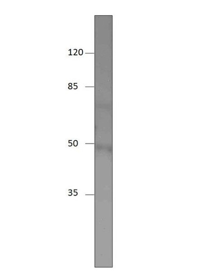 Western blot with Anti-SHISA9 isoform X2 Antibody (STJ500558) of rat lung at 1:250 antibody dilution in buffer for 1 hour at room temperature, from a 10% SDS gel.