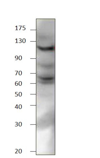 Western blot with Anti-EPHA8 Antibody (STJ500927) of SKNMC cell at 1:500 dilution in buffer.