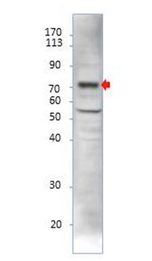 Western blot with Anti-ESR1 Antibody (STJ500969) and peptide at 1:500 dilution in buffer.