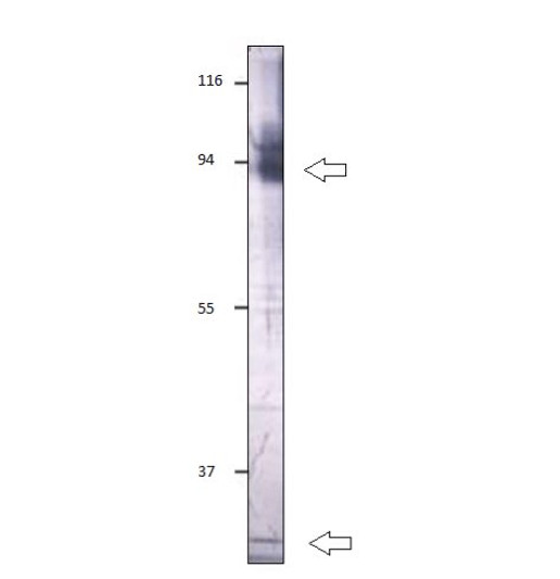 Western blot with Anti-LARP7 Antibody (STJ501573) with peptide at 1:500 dilution in buffer.