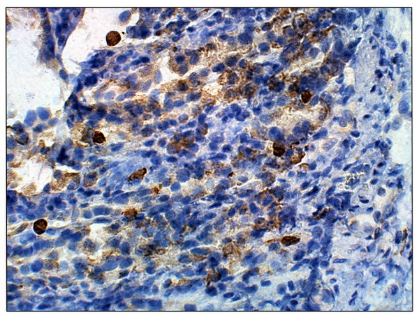 Immunohistochemistry of mouse Colon with Anti-TRIM63 primary antibody (STJ501822) at 1:100 dilution in Buffer. Section was treated with DAB and Haematoxylin stain. Magnification is at 40X.