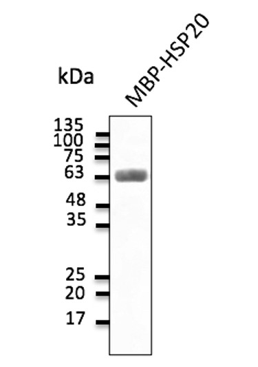 Anti-HSP20 antibody at 1:2,000 dilution; 30 ng of protein per lane; chicken polyclonal to goat IgG conjugated to HRP (STJ140211) at 1:10000 dilution