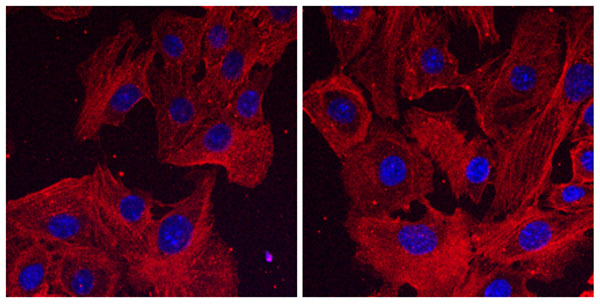 Immunofluorescence using hCEC cells, 1st antibody (anti-beta-Actin at 1/250) and 2nd antibody (anti-mouse STJ140232 at 1:1,000) ; cells were fixed with methanol