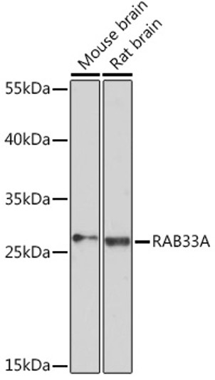 Western blot analysis of various lysates using RAB33A Rabbit polyclonal antibody (STJ11102839) at 1:3000 dilution. Secondary antibody: HRP Goat Anti-Rabbit IgG (H+L) (STJS000856) at 1:10000 dilution. Lysates/proteins: 25 Mu g per lane. Blocking buffer: 3% nonfat dry milk in TBST. Detection: ECL Basic Kit. Exposure time: 90s.
