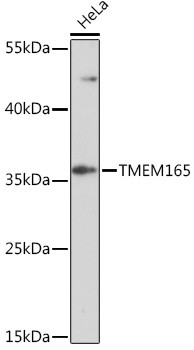Western blot analysis of lysates from HeLa cells, using TMEM165 Rabbit polyclonal antibody (STJ11102872) at 1:1000 dilution. Secondary antibody: HRP Goat Anti-Rabbit IgG (H+L) (STJS000856) at 1:10000 dilution. Lysates/proteins: 25 Mu g per lane. Blocking buffer: 3% nonfat dry milk in TBST. Detection: ECL Enhanced Kit. Exposure time: 5min.
