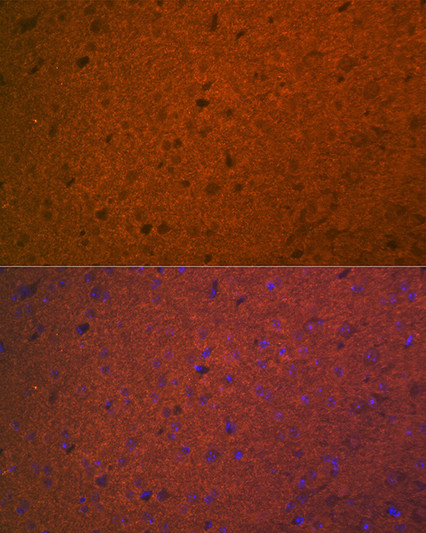 Immunofluorescence analysis of mouse brain using STX1A Rabbit monoclonal antibody (STJ11102975) at dilution of 1:100 (40x lens). Blue: DAPI for nuclear staining.