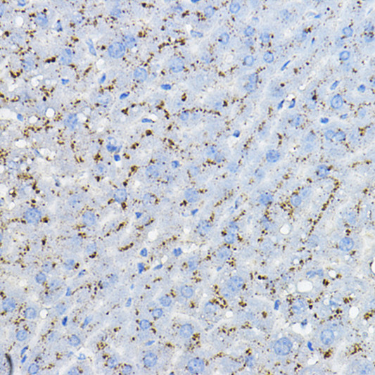 Immunohistochemistry analysis of MPC2 in paraffin-embedded mouse liver using MPC2 Rabbit polyclonal antibody (STJ11103220) at dilution of 1:100 (40x lens). Perform high pressure antigen retrieval with 10 mM citrate buffer pH 6. 0 before commencing with immunohistochemistry staining protocol.