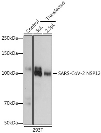 Western blot analysis of extracts of normal 293T cells 293T transfected with NSP12 Protein, using SARS-CoV-2 NSP12 Rabbit polyclonal antibody (STJ11103234) at 1:5000 dilution. Secondary antibody: HRP Goat Anti-Rabbit IgG (H+L) (STJS000856) at 1:10000 dilution. Lysates/proteins: 25 Mu g per lane. Blocking buffer: 3% nonfat dry milk in TBST. Detection: ECL Basic Kit. Exposure time: 10s.