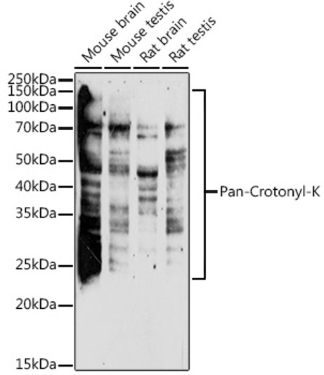 Western blot analysis of various lysates using Pan-Crotonyl-K Rabbit polyclonal antibody (STJ11103352) at 1:1000 dilution. Secondary antibody: HRP Goat Anti-Rabbit IgG (H+L) (STJS000856) at 1:10000 dilution. Lysates/proteins: 25 Mu g per lane. Blocking buffer: 3% nonfat dry milk in TBST. Detection: ECL Enhanced Kit. Exposure time: 180s. Western blot analysis of various lysates using Pan-Crotonyl-K Rabbit polyclonal antibody (STJ11103352) at 1:1000 dilution. Secondary antibody: HRP Goat Anti-Rabbit IgG (H+L) (STJS000856) at 1:10000 dilution. Lysates/proteins: 25 Mu g per lane. Blocking buffer: 3% nonfat dry milk in TBST. Detection: ECL Enhanced Kit. Exposure time: 180s.