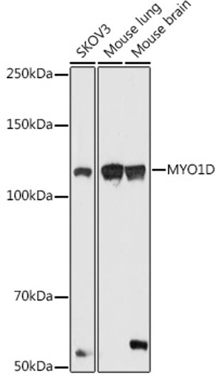 Western blot analysis of extracts of various cell lines, using MYO1D antibody (STJ11103357) at 1:1000 dilution. Secondary antibody: HRP Goat Anti-Rabbit IgG (H+L) (STJS000856) at 1:10000 dilution. Lysates/proteins: 25 Mu g per lane. Blocking buffer: 3% nonfat dry milk in TBST. Detection: ECL Basic Kit. Exposure time: 180s.