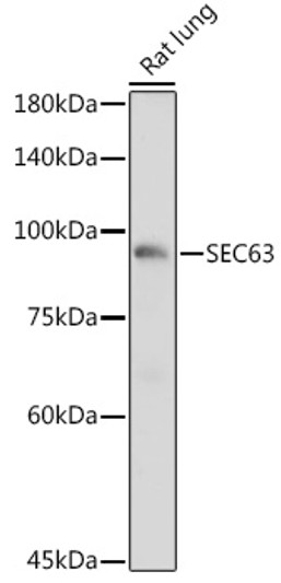 Western blot analysis of extracts of Rat lung, using SEC63 antibody (STJ11103377) at 1:1000 dilution. Secondary antibody: HRP Goat Anti-Rabbit IgG (H+L) (STJS000856) at 1:10000 dilution. Lysates/proteins: 25 Mu g per lane. Blocking buffer: 3% nonfat dry milk in TBST. Detection: ECL Basic Kit. Exposure time: 1s.