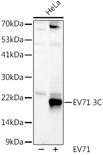Western blot analysis of lysates from HeLa cells, using EV71 3C Rabbit polyclonal antibody (STJ11103414) at 1:1000 dilution. Secondary antibody: HRP Goat Anti-Rabbit IgG (H+L) (STJS000856) at 1:10000 dilution. Lysates/proteins: 25 Mu g per lane. Blocking buffer: 3% nonfat dry milk in TBST. Detection: ECL Basic Kit. Exposure time: 90s. Western blot analysis of lysates from HeLa cells, using EV71 3C Rabbit polyclonal antibody (STJ11103414) at 1:1000 dilution. Secondary antibody: HRP Goat Anti-Rabbit IgG (H+L) (STJS000856) at 1:10000 dilution. Lysates/proteins: 25 Mu g per lane. Blocking buffer: 3% nonfat dry milk in TBST. Detection: ECL Basic Kit. Exposure time: 90s.
