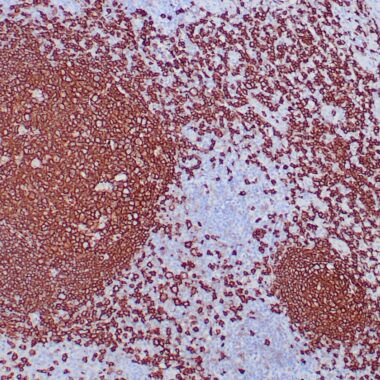 Anti-CD20 antibody IHC human lymph node STJ180556