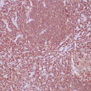 Anti-CD45RB (LCA) antibody IHC human lymph node STJ180559
