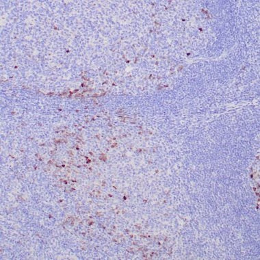 Anti-IgG antibody IHC human tonsil STJ180575
