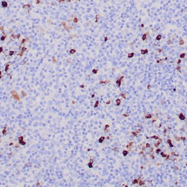 Anti-IgM antibody IHC human tonsil STJ180576